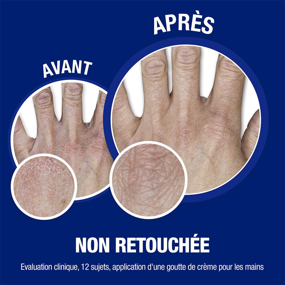 Confronto mani: Prima/Dopo. Pelle con e senza applicazione. Testo: Non ritoccato. Valutazione clinica.