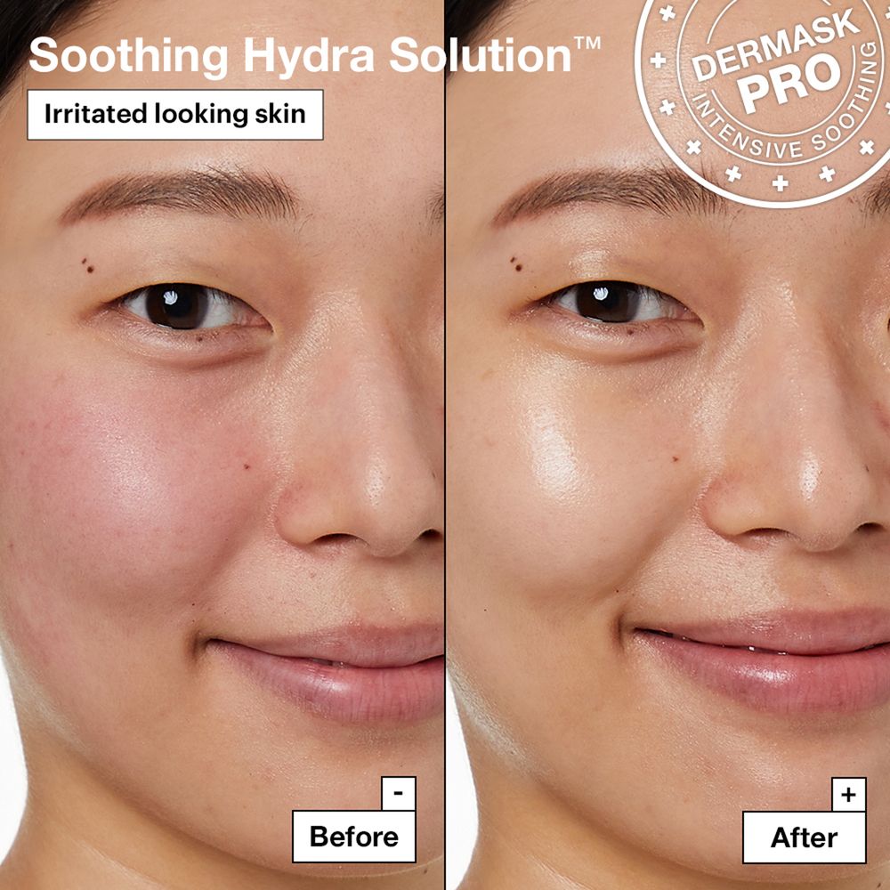 Immagine prima e dopo. Viso con pelle arrossata, poi pelle liscia. Testo: Soothing Hydra Solution™.