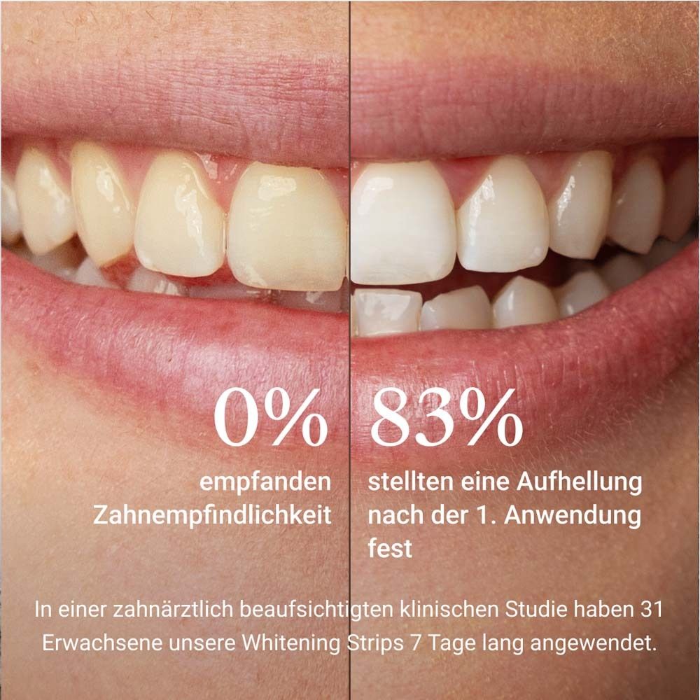 Confronto: denti prima e dopo l'uso. 0% vs. 83% di sbiancamento.