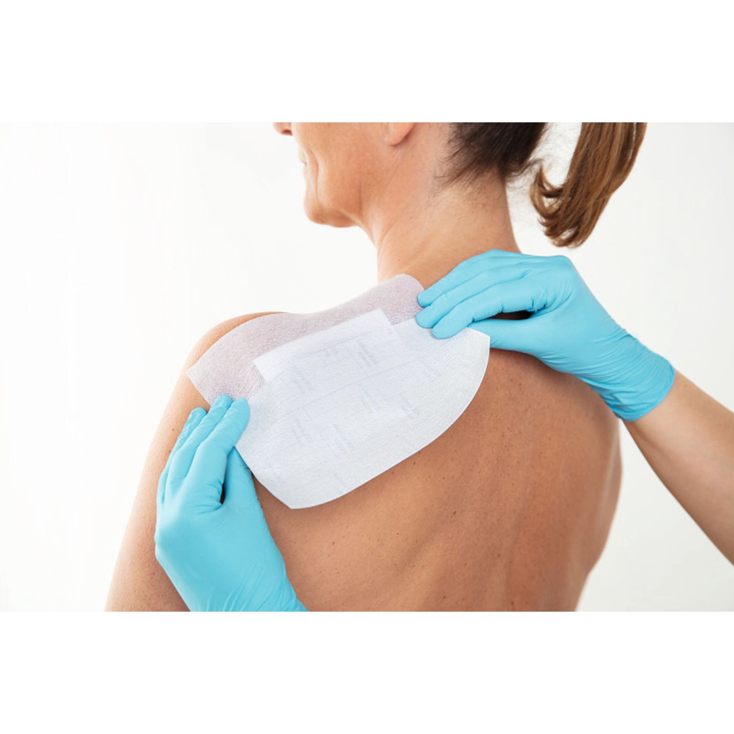Fixomull® stretch applicato su una ferita sulla schiena. Mani con guanti.