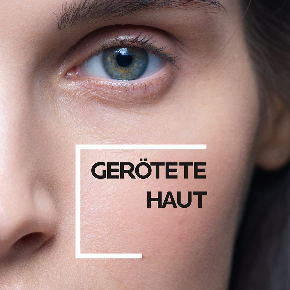 Primo piano di un viso con pelle arrossata, incorniciato da un riquadro bianco.