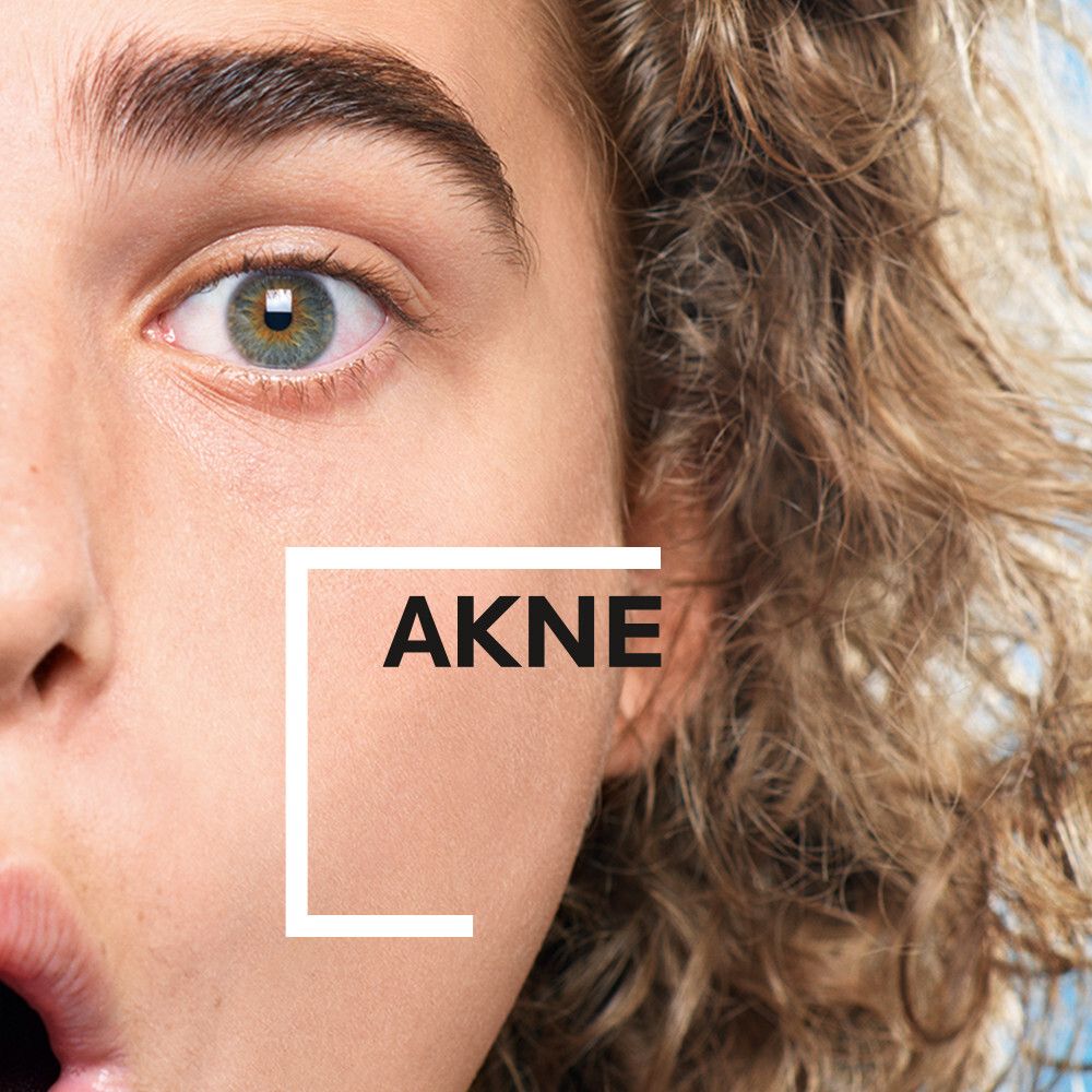 Viso di una donna. Testo: ACNE.