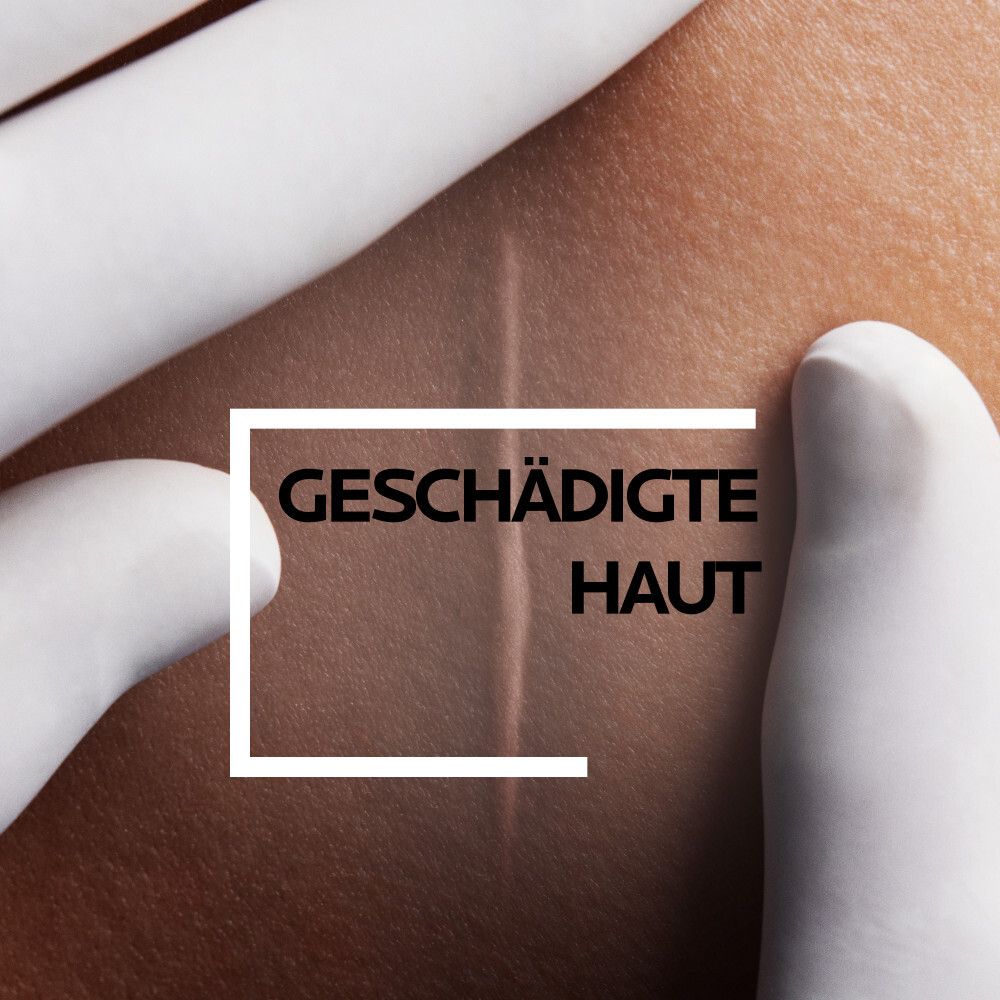 Illustrazione: Pelle danneggiata. Testo in una scatola bianca.