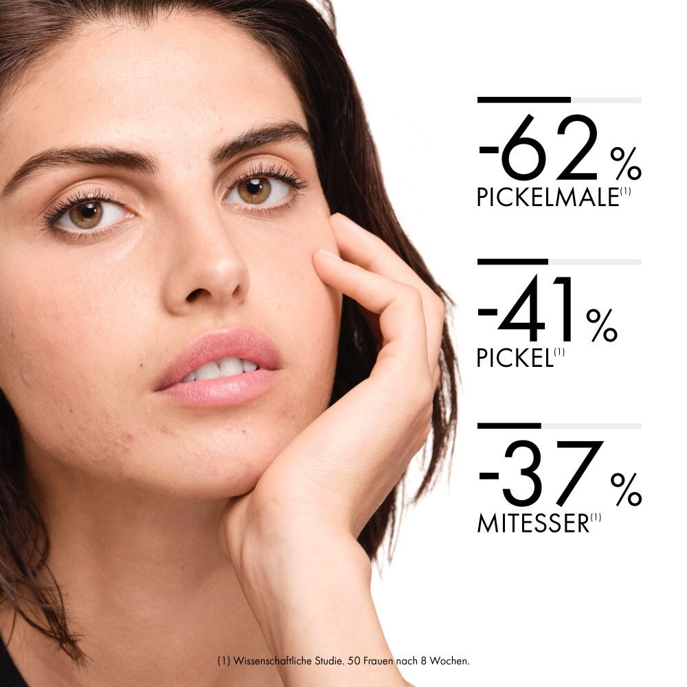 Viso di donna con problemi di pelle, accanto a percentuali su macchie post-acne (-62%), brufoli (-41%) e punti neri (-37%).