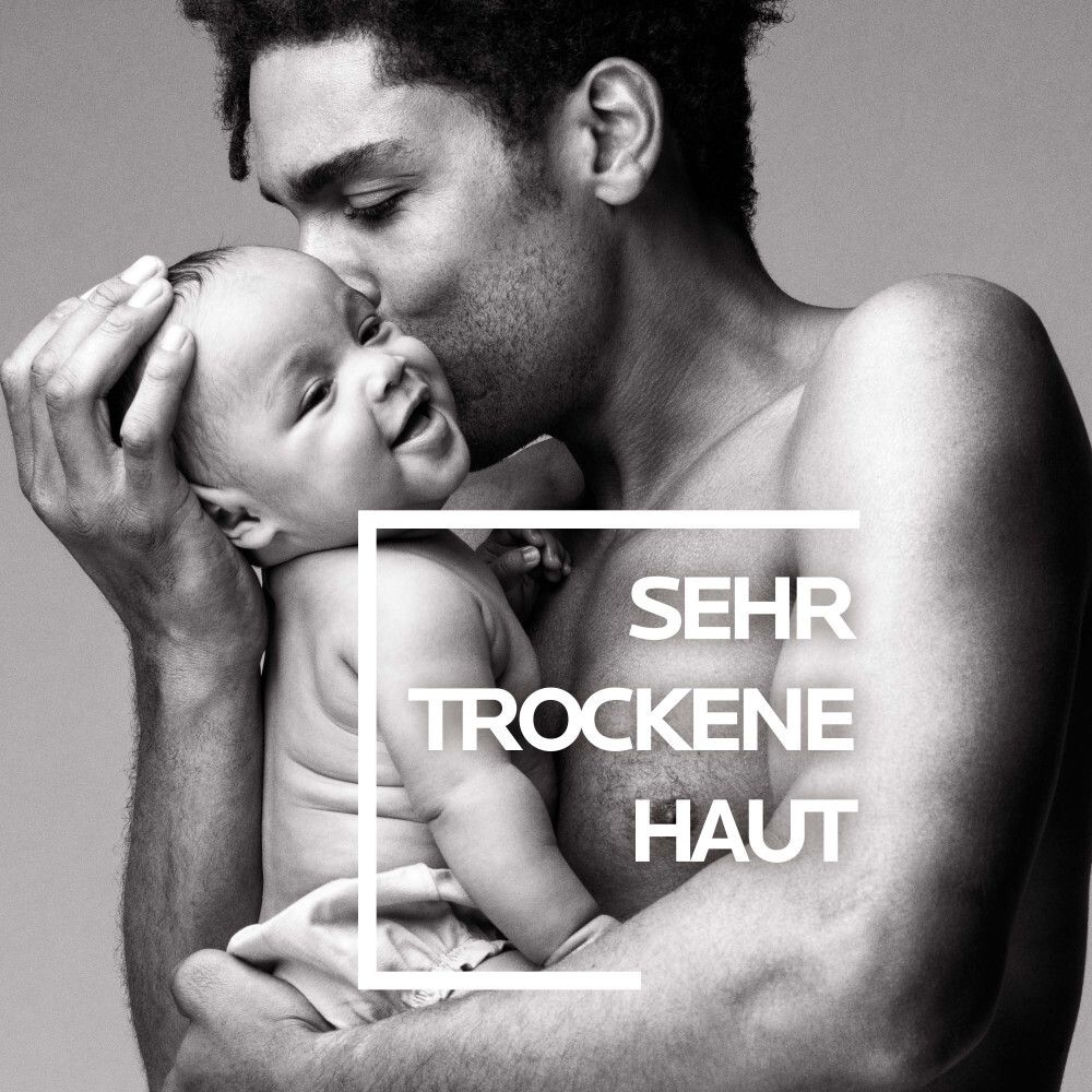 Uomo che abbraccia un bambino. Testo: Pelle molto secca.