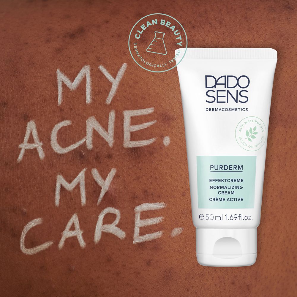 Tubo con prodotto e scritta sulla pelle. Testo: My Acne. My Care. Logo e nome del prodotto visibili.