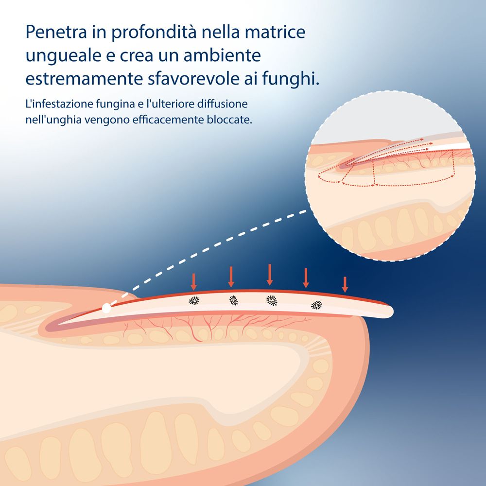 Infografica: l'85% degli utenti soddisfatti dopo 3 mesi. Evolsin Liquid.