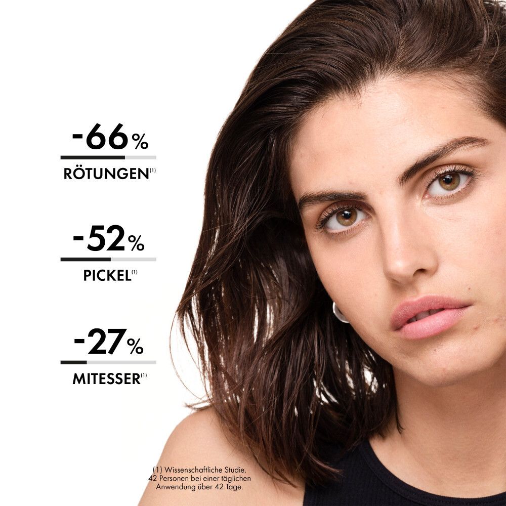 Volto di donna. Testo: -66% rossori, -52% brufoli, -27% punti neri. Studio scientifico.