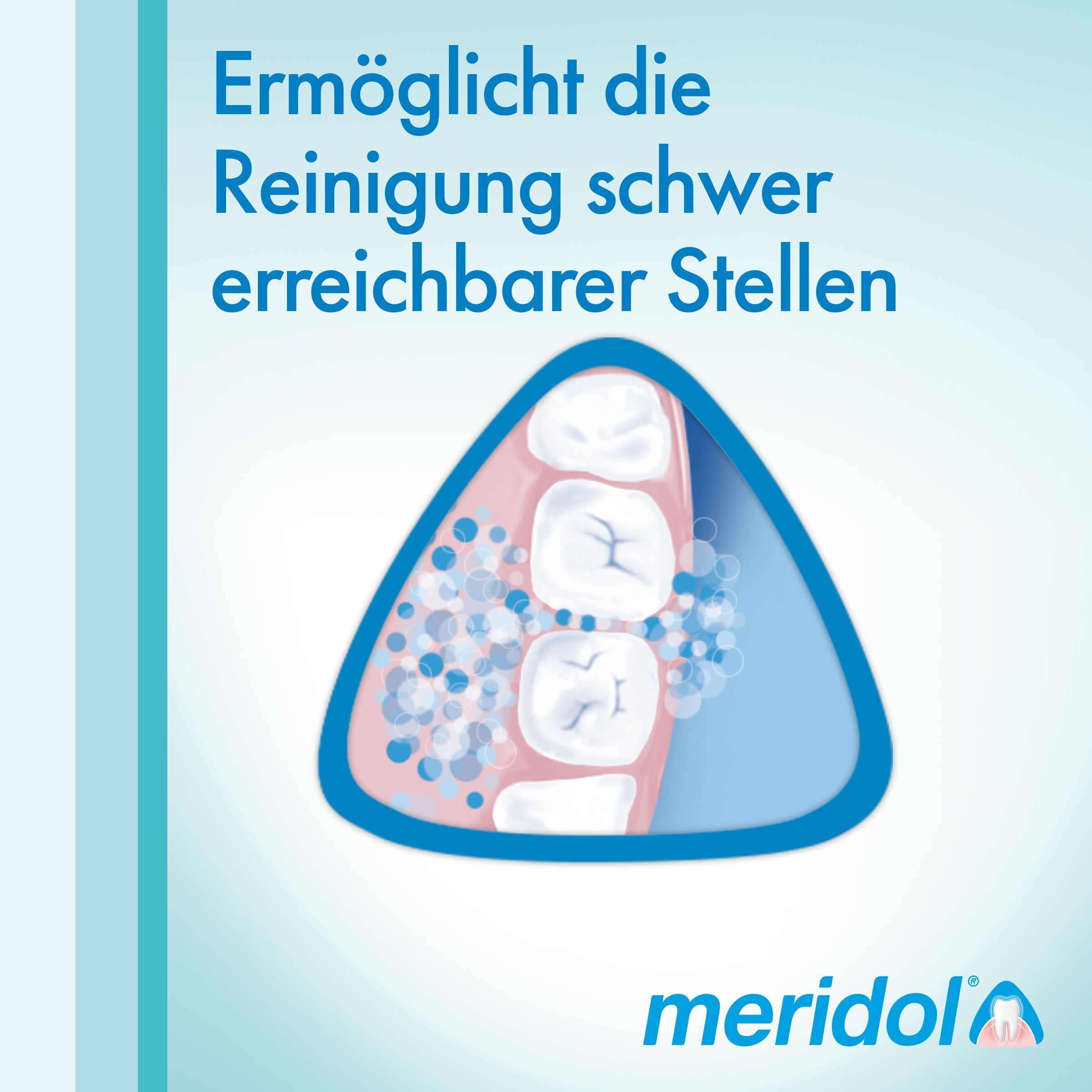 Illustrazione di denti con particelle detergenti in aree difficili da raggiungere.