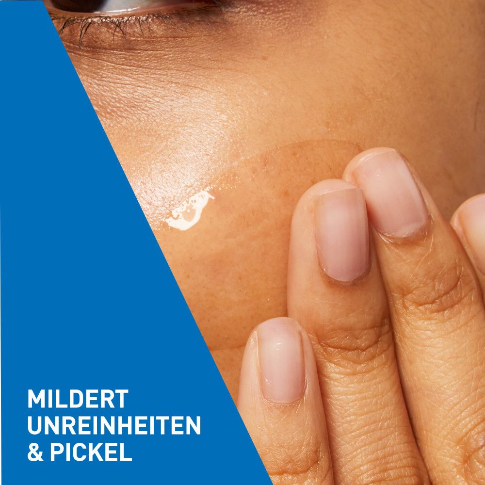 Primo piano di una zona della pelle. Applicazione del gel. Attenua imperfezioni e brufoli.