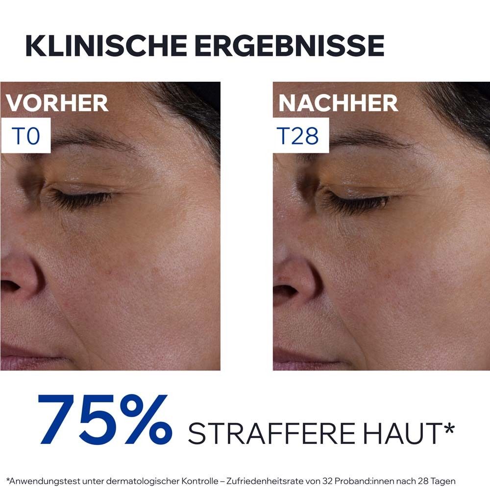 Confronto prima-dopo. Metà del viso. T0 e T28. 75% di pelle più tonica. Test sotto controllo dermatologico.