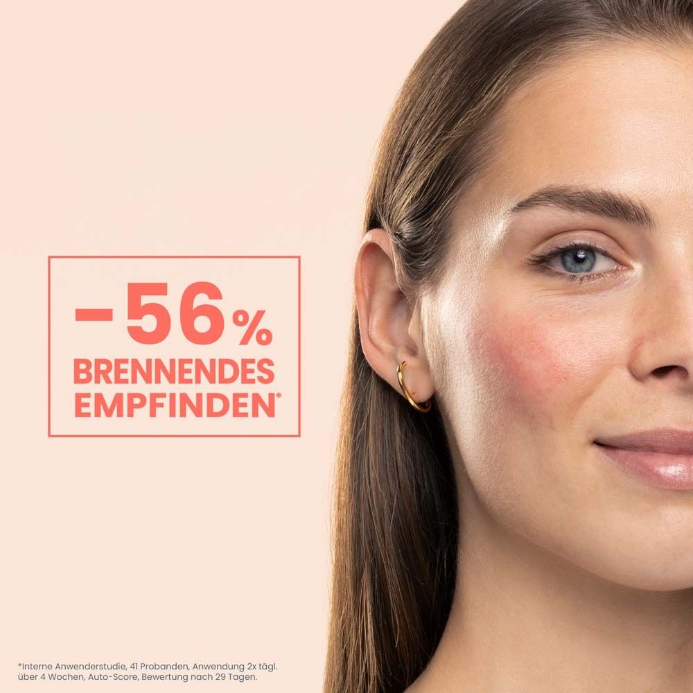 Donna con pelle arrossata. Testo: -56% sensazione di bruciore. Nessuna immagine del prodotto.