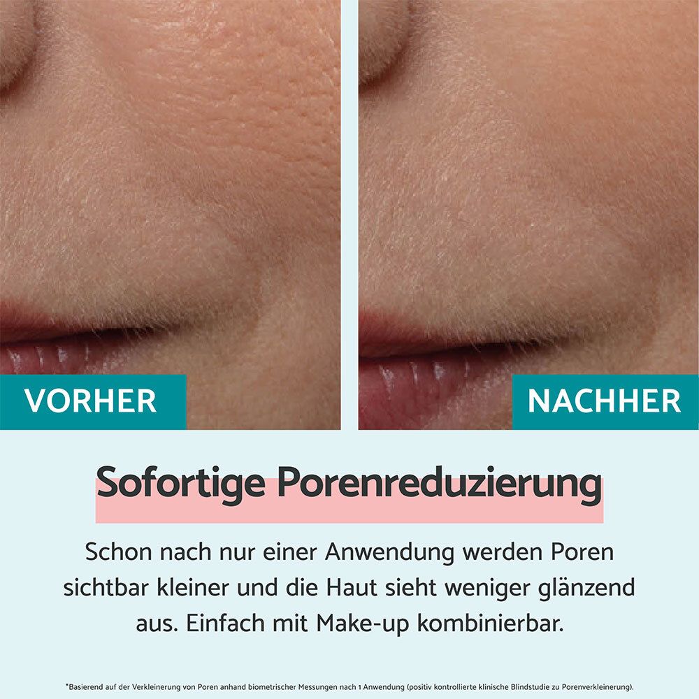 Immagine comparativa: pelle prima e dopo l'applicazione. Testo: Riduzione istantanea dei pori. Pelle meno lucida.