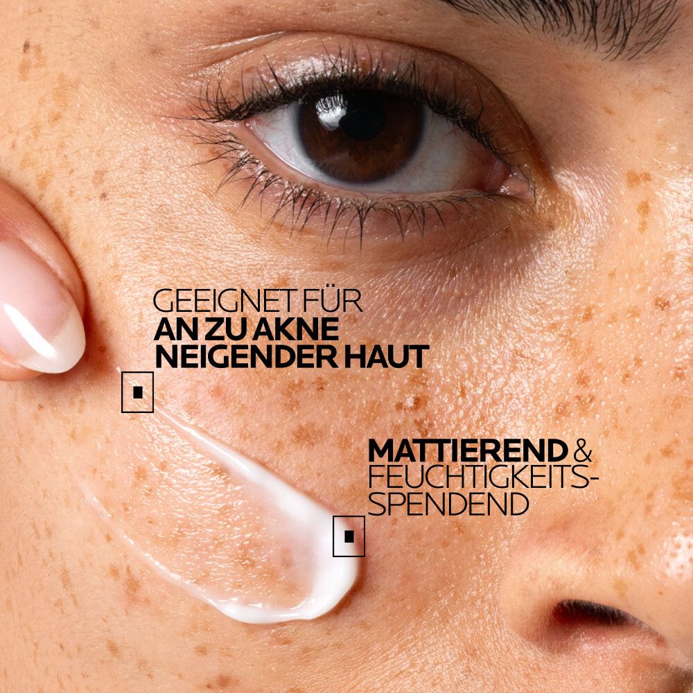 Applicazione di crema su pelle lentigginosa, indicazione della texture.