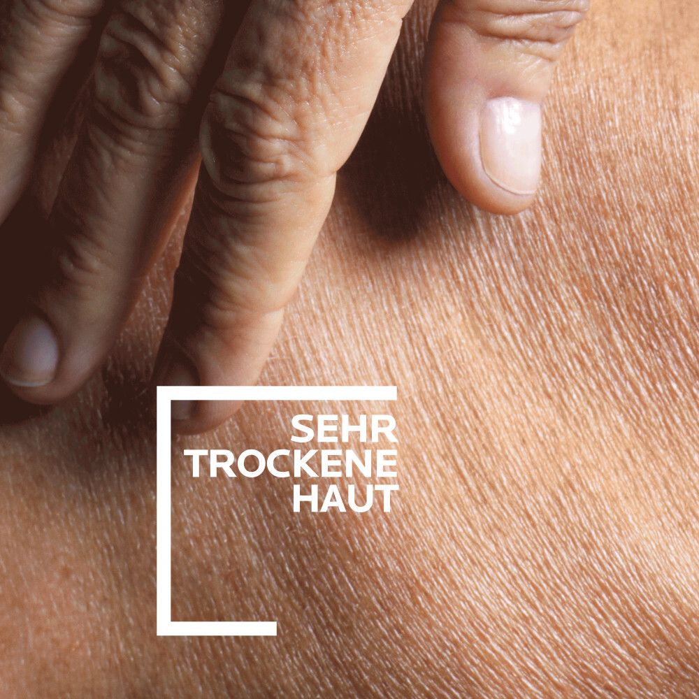 Primo piano pelle molto secca. Texture con segni visibili di secchezza.