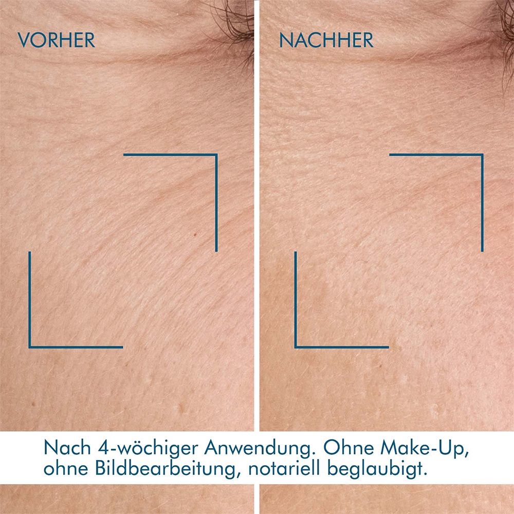 Confronto prima-dopo della pelle. Testo: Dopo 4 settimane di utilizzo. Senza trucco, senza ritocchi.