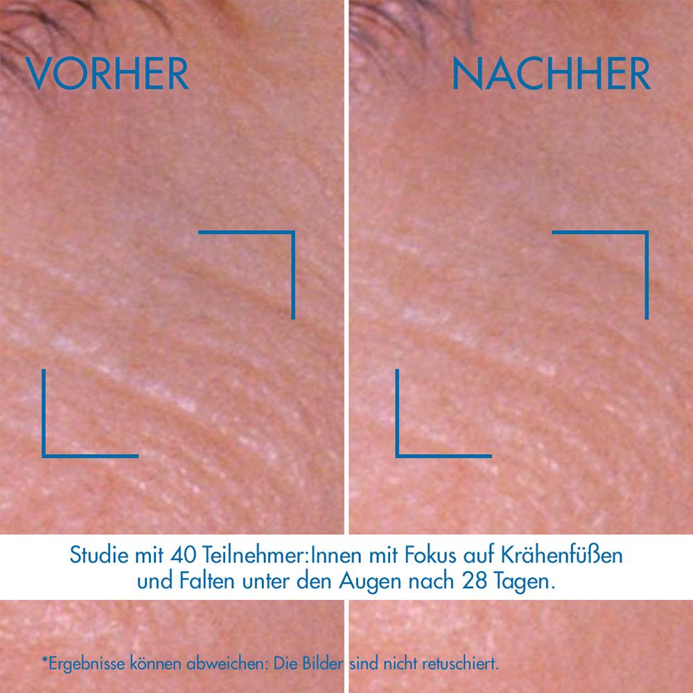Confronto prima-dopo. Focus sulle rughe sotto gli occhi. Testo.