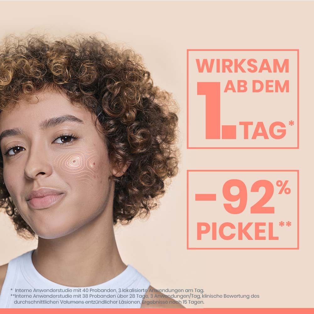 Donna con capelli ricci e linee topografiche sulla guancia, che evidenziano l'efficacia dal 1° giorno e -92% di brufoli.