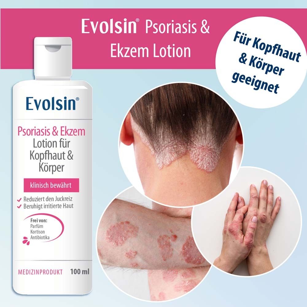 Flacone bianco con lozione. Testo: Evolsin Lozione Psoriasi & Eczema. Adatto per cuoio capelluto e corpo. 100 ml. Medico.