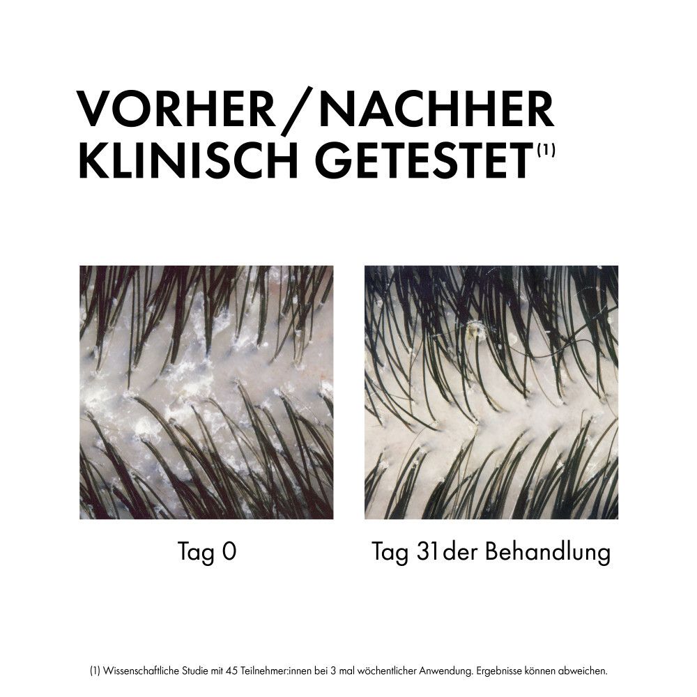 Shampoo Dercos antiforfora. Tre flaconi: da normale a grassa, secca e tutti i tipi di cuoio capelluto.