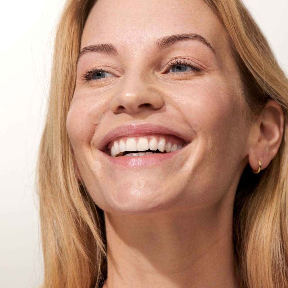 Donna con cerotti per brufoli sulla pelle. Cerotti rotondi e trasparenti. Applicazione.