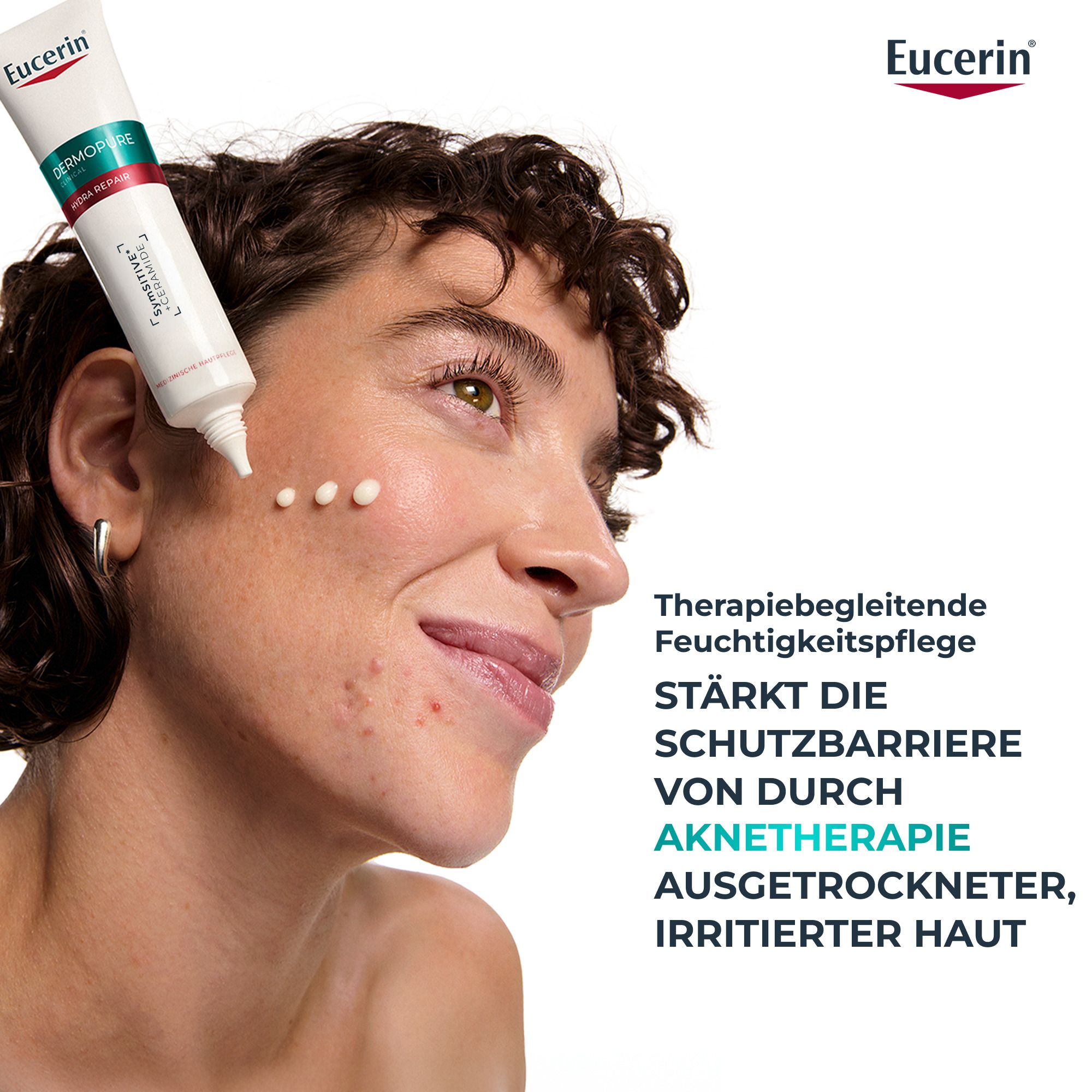Applicazione della crema Eucerin Dermopure Hydra Repair su pelle a tendenza acneica.