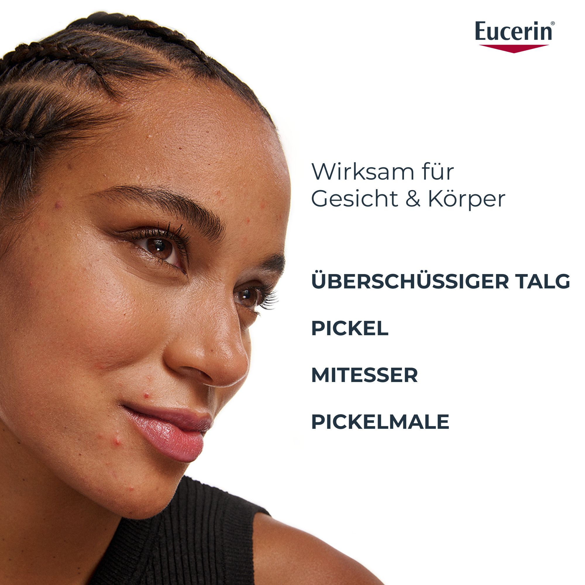 Donna con imperfezioni cutanee. Eucerin Dermopure Clinical agisce su sebo in eccesso, brufoli, punti neri, macchie.