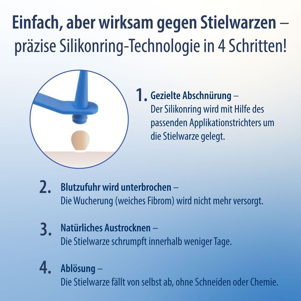 Istruzioni per l'uso di Evolsin Anti Stielwarze. 4 passaggi per rimuovere le verruche.