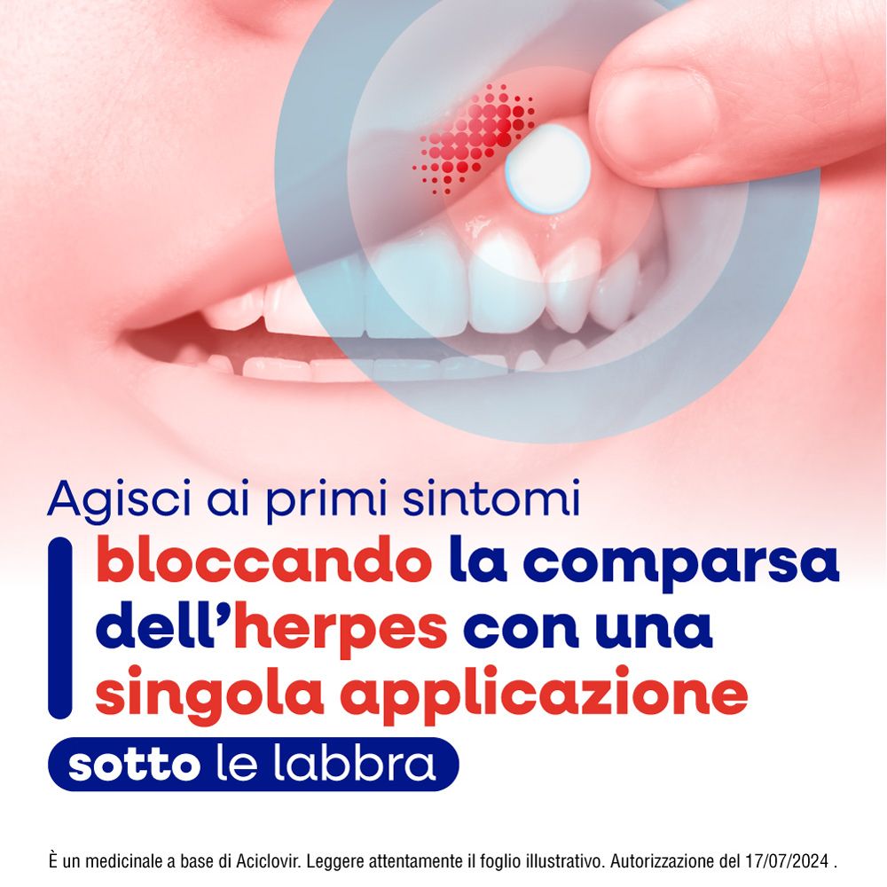 Herpmed Labiale Compresse Buccali Mucoadesive Aciclovir 50mg