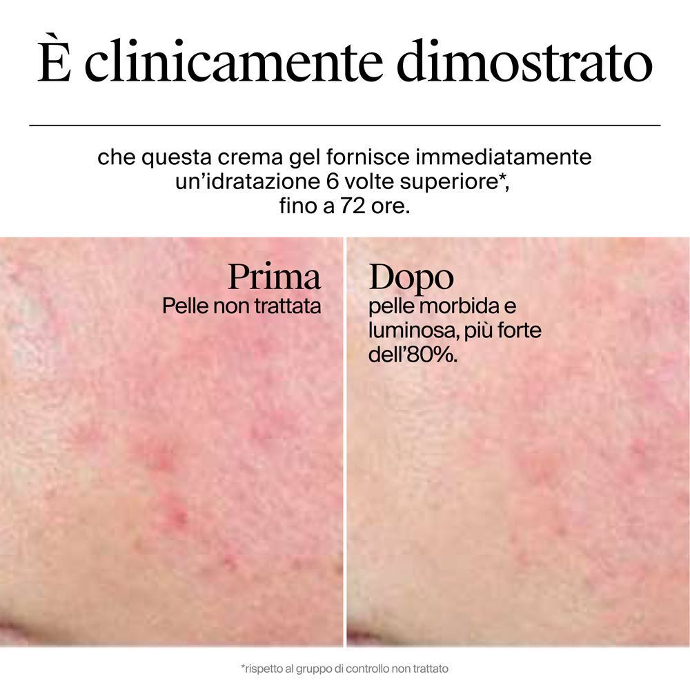 Confronto prima e dopo della pelle dopo l'applicazione della crema.