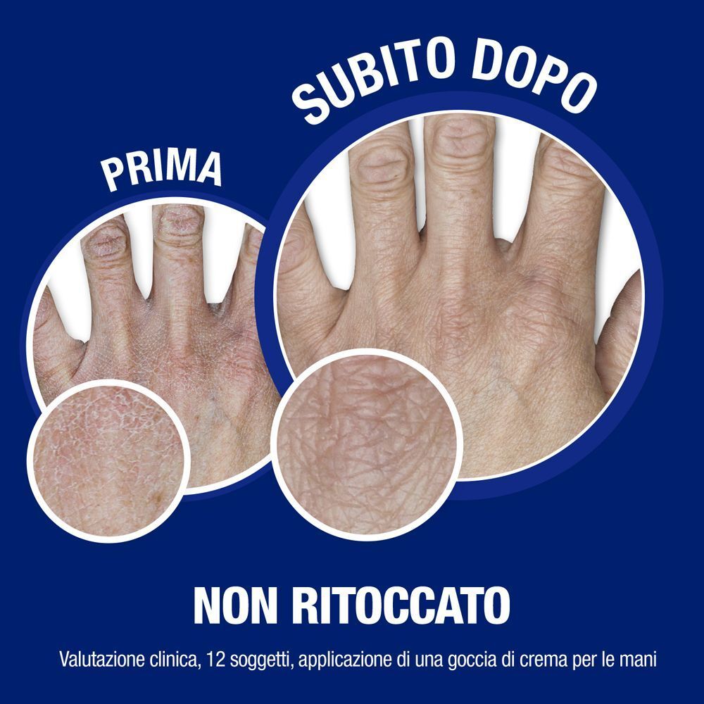 Confronto prima e dopo mani secche dopo l'applicazione della crema.