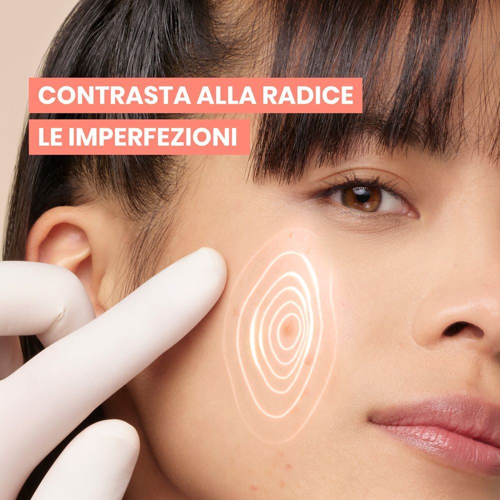 Viso di donna con imperfezioni cutanee. Rappresentazione circolare delle imperfezioni. Testo: Contrasta le imperfezioni.