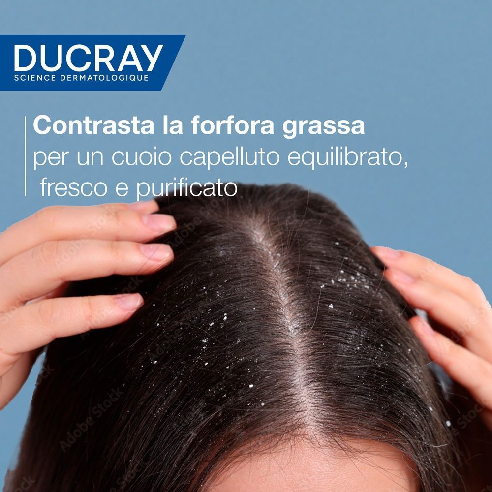 Testa con forfora. Testo: Contrasta la forfora grassa per un cuoio capelluto equilibrato, fresco e purificato.