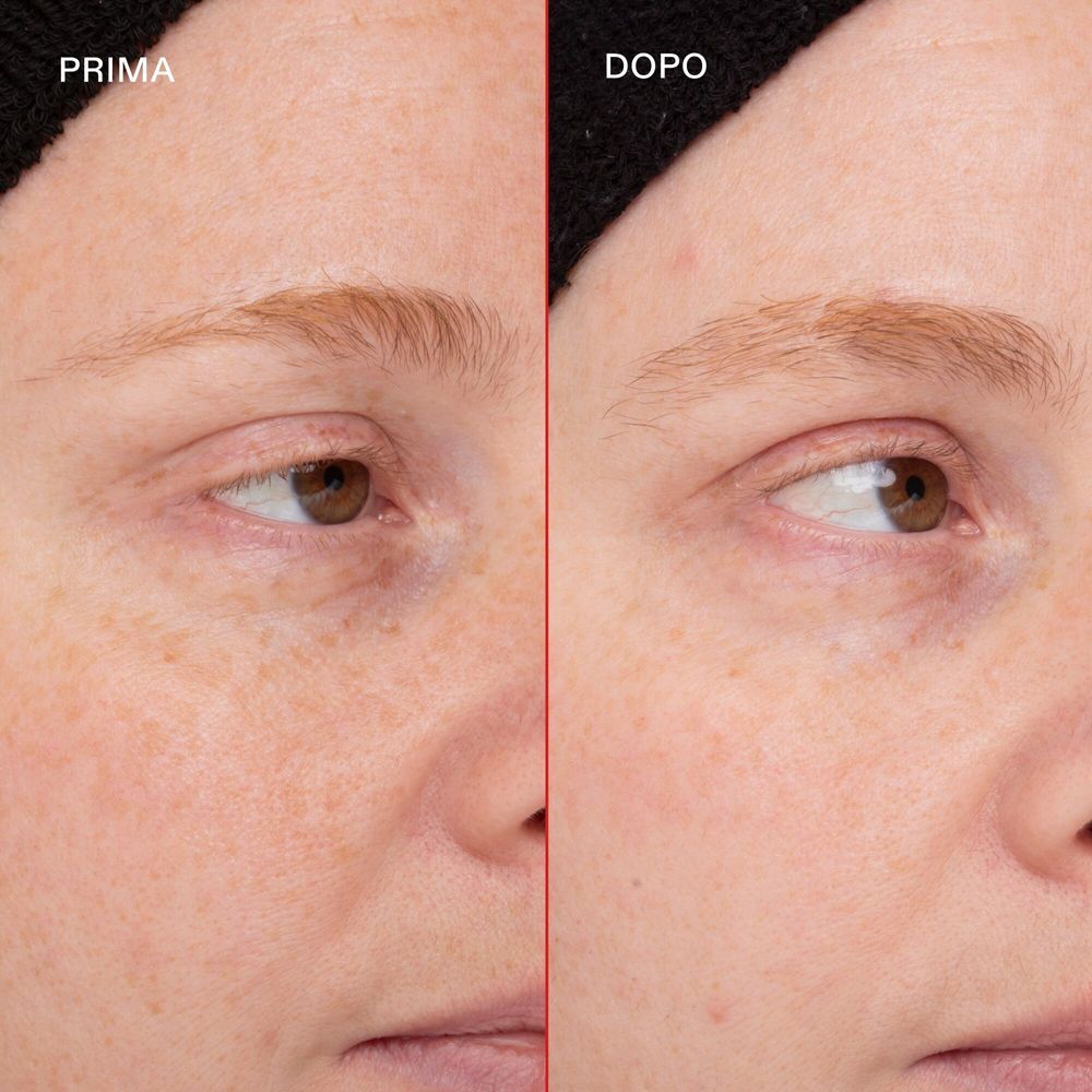 Confronto prima e dopo delle sopracciglia di una persona che utilizza il siero Olaplex Browbond.