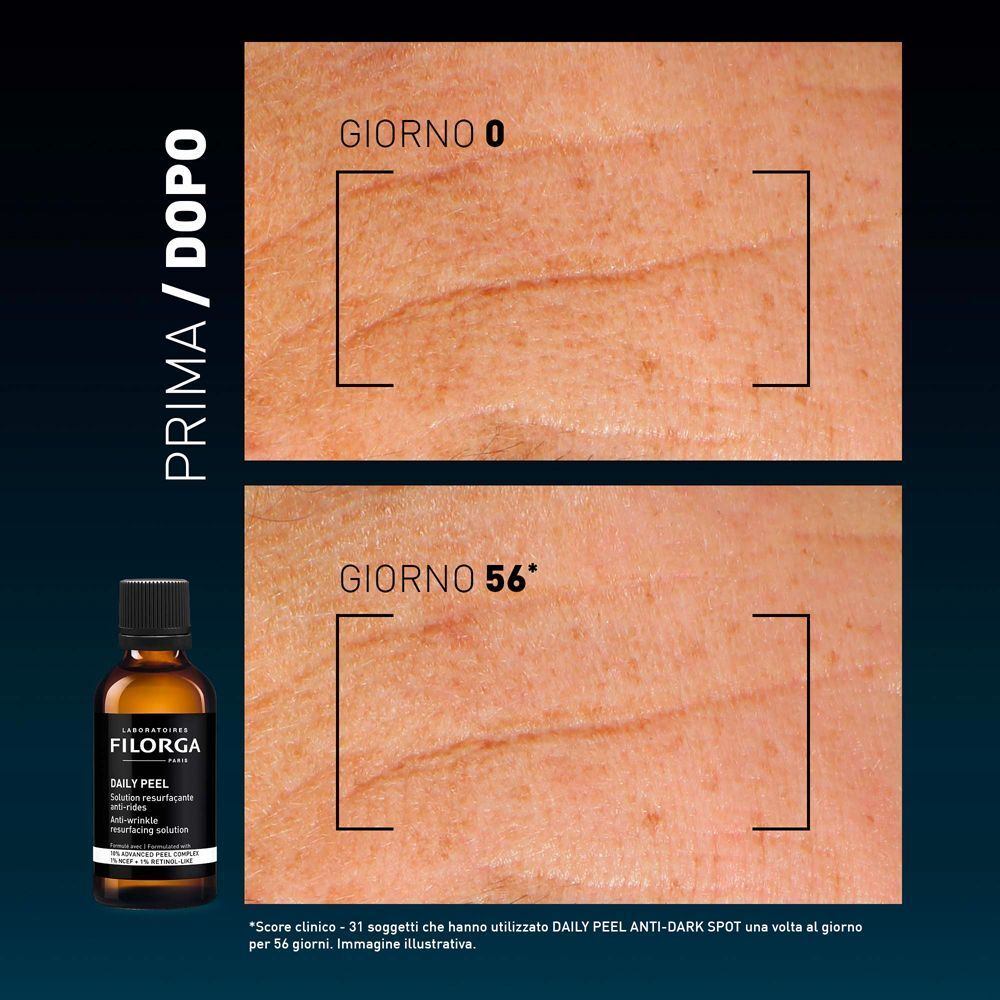 Confronto prima/dopo della pelle con Filorga Daily Peel Anti-Wrinkle.