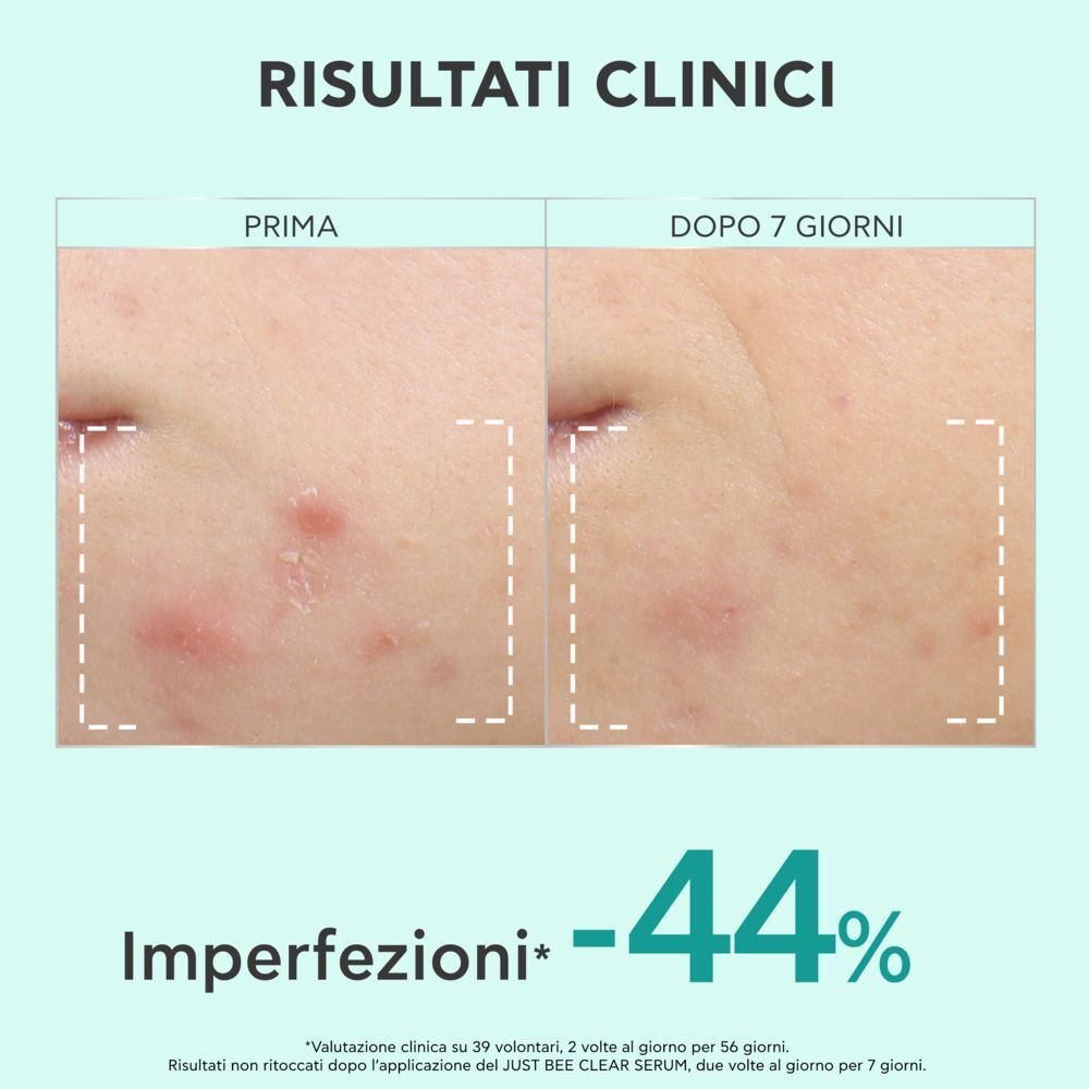 Confronto prima e dopo imperfezioni dopo 7 giorni. Testo: 'Risultati Clinici'.