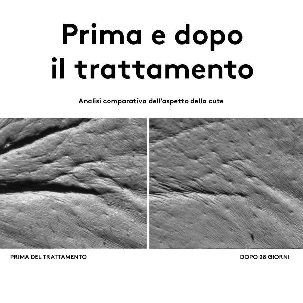 Confronto prima e dopo della texture della pelle del contorno occhi. Prima e dopo 28 giorni di trattamento.