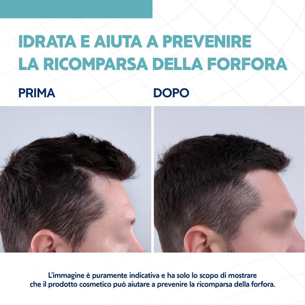 Confronto prima e dopo del cuoio capelluto dopo l'uso dello shampoo.