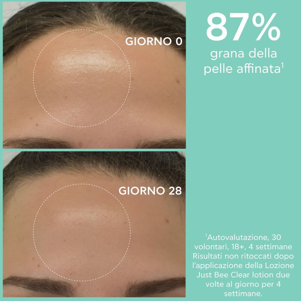Confronto prima/dopo della fronte. Giorno 0 e Giorno 28. Testo: '87% grana della pelle affinata'.