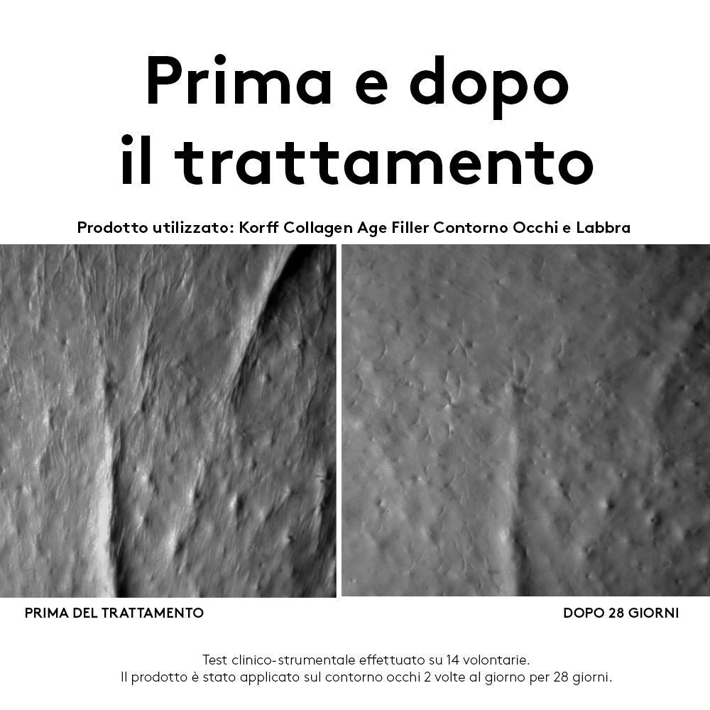 Confronto prima e dopo della texture della pelle trattata con KORFF Collagen Age Filler.