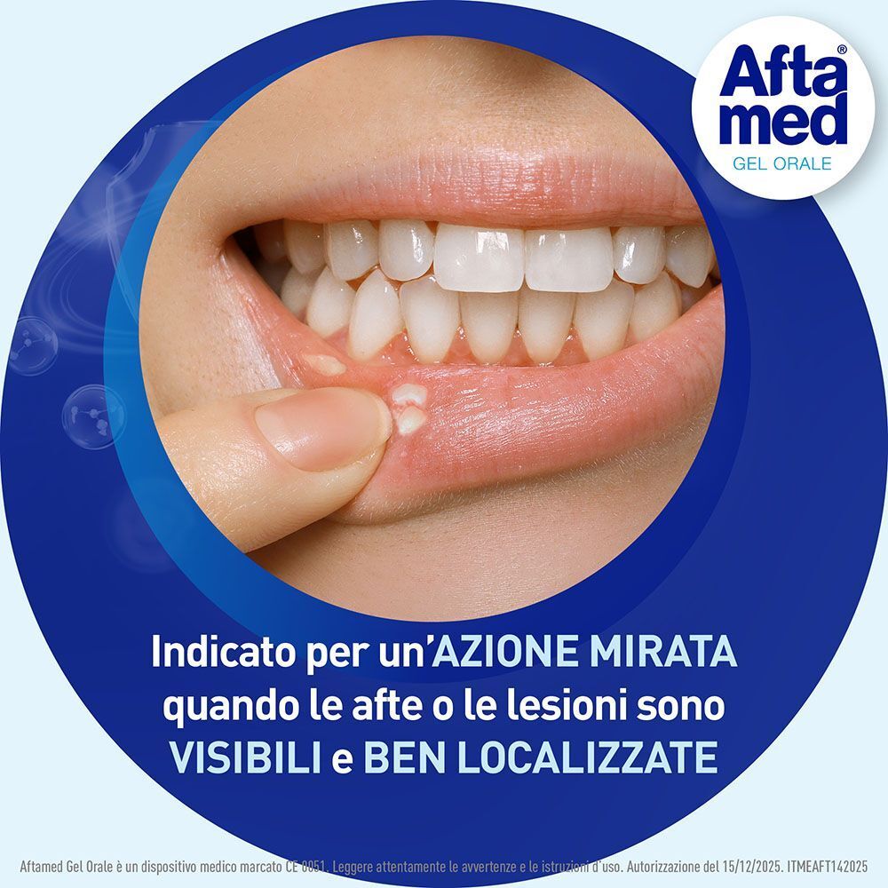 Afta Med Gel Orale: azione mirata quando le afte sono visibili e localizzate.