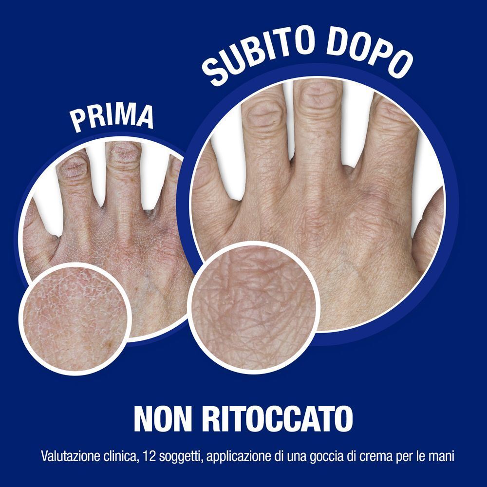 Confronto prima e dopo mani secche con crema mani Neutrogena.
