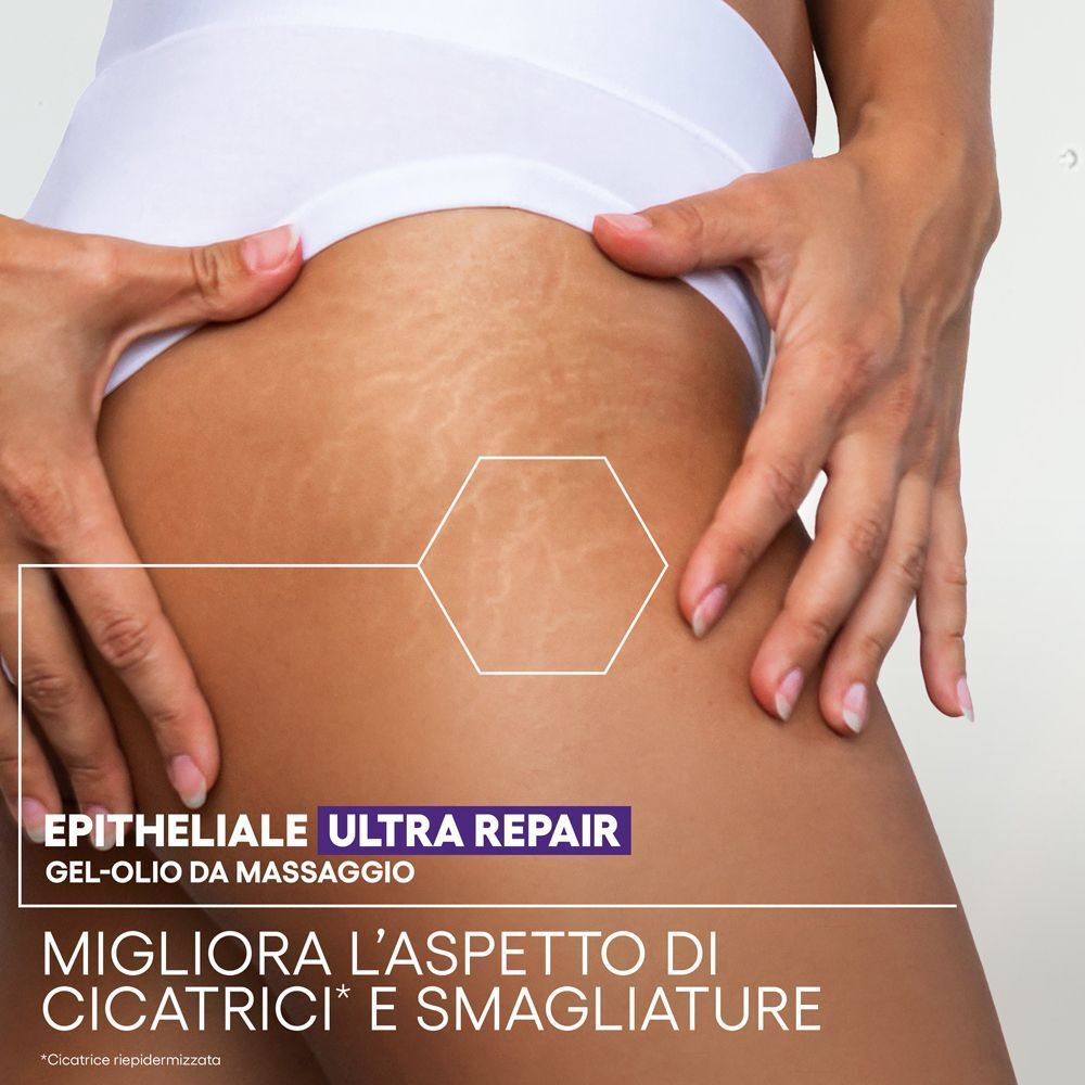 Pelle con smagliature trattata con A-Derma Epitheliale Ultra Repair.
