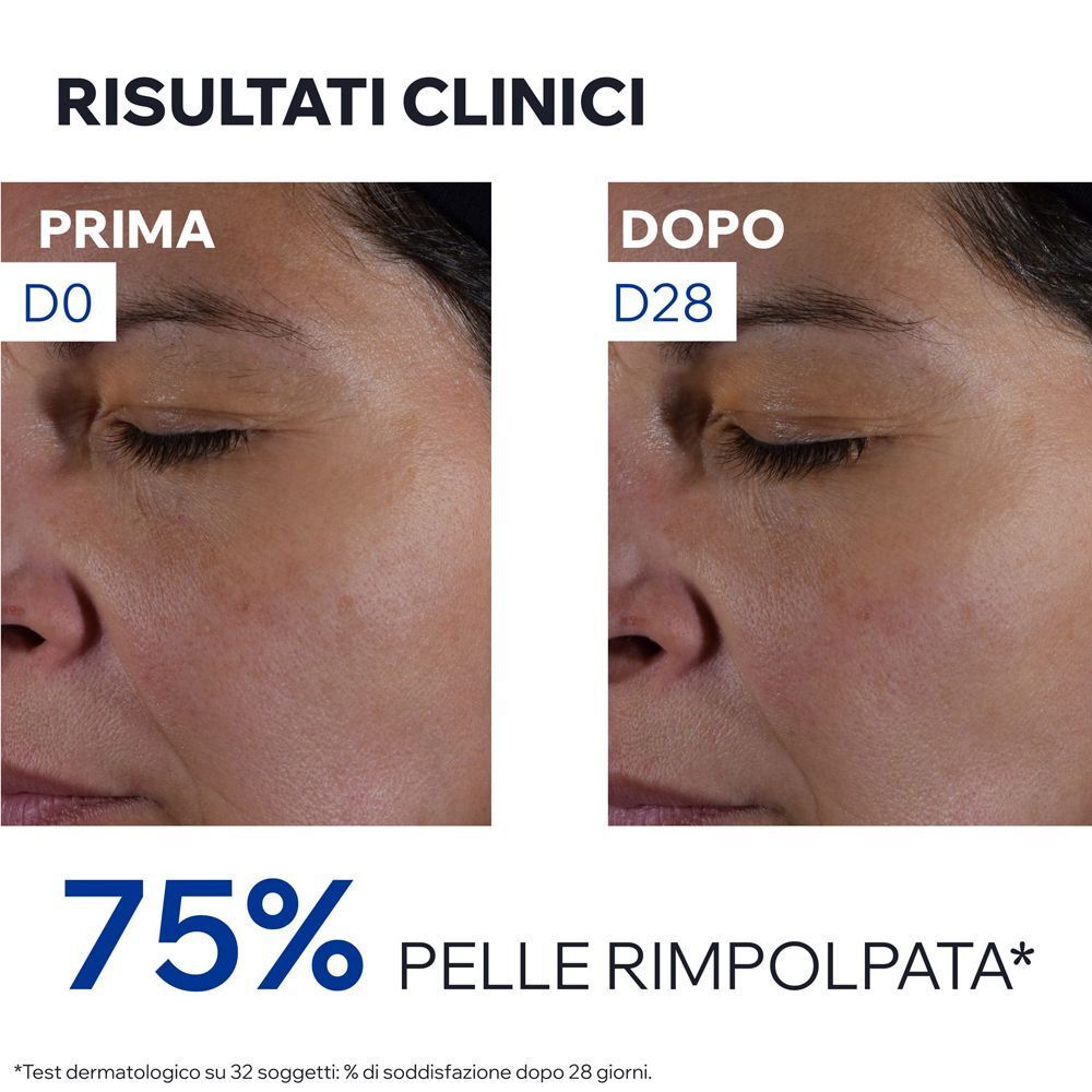 Risultati clinici: Confronto prima/dopo mostra il 75% di pelle rimpolpata dopo 28 giorni.