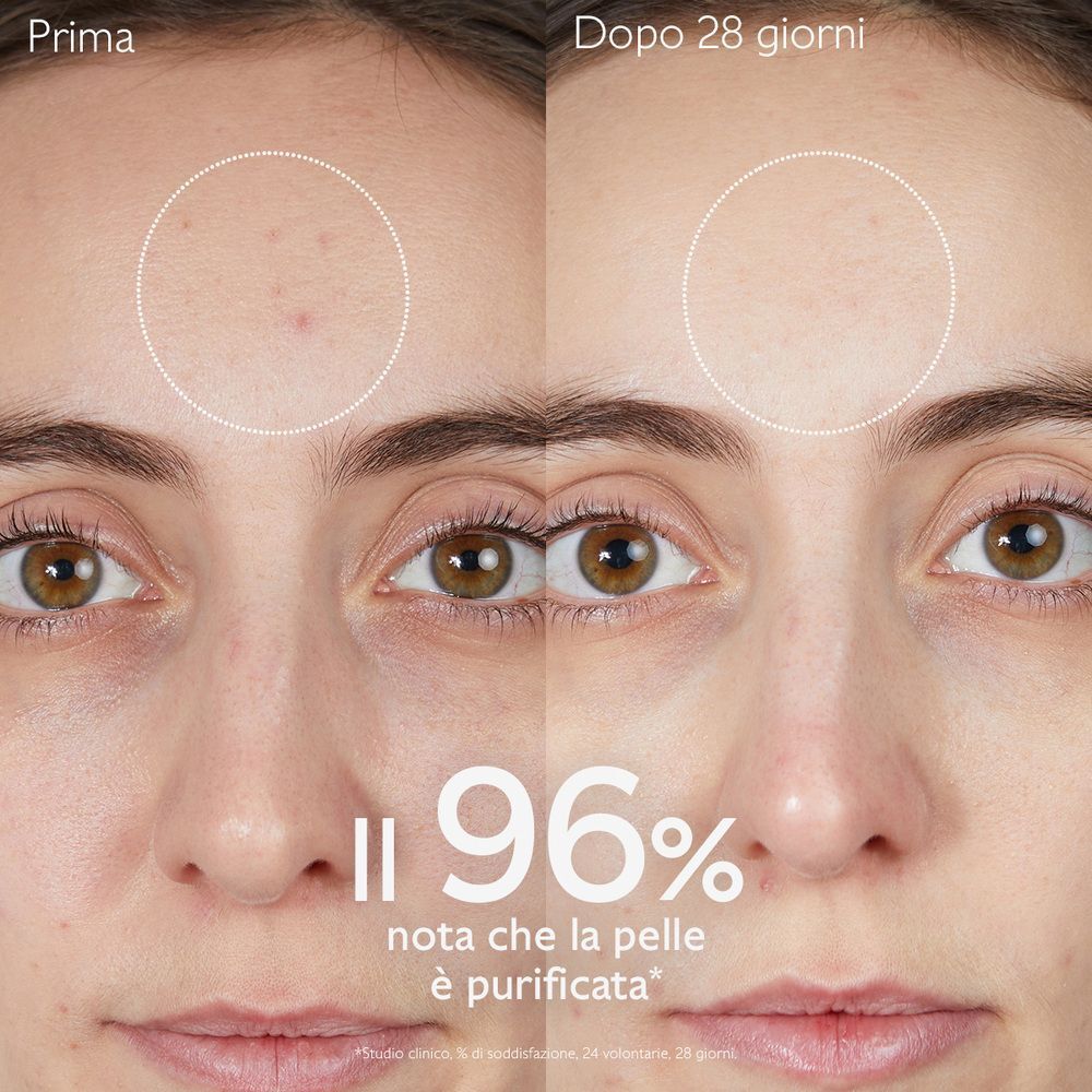 Confronto pelle prima e dopo 28 giorni con Caudalie Vinopure Gel Detergente.