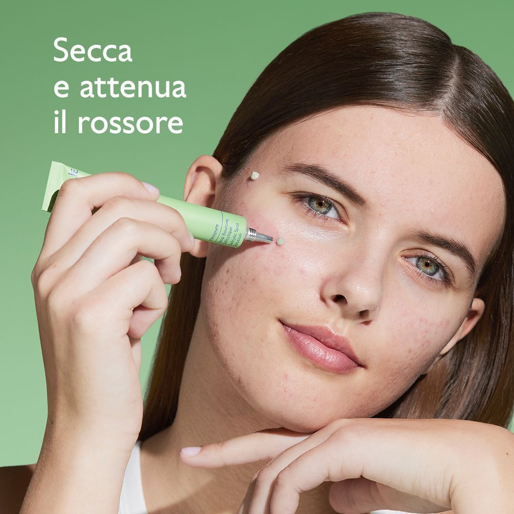 Una donna applica la Soluzione Salicilica Caudalie Vinopure su un brufolo.
