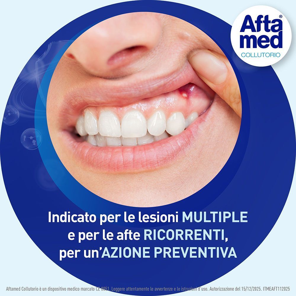 Collutorio Aftamed: indicato per lesioni multiple e afte ricorrenti.