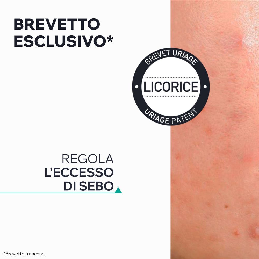 Gel SOS Uriage Hyseac: Brevetto esclusivo alla liquirizia che regola il sebo.