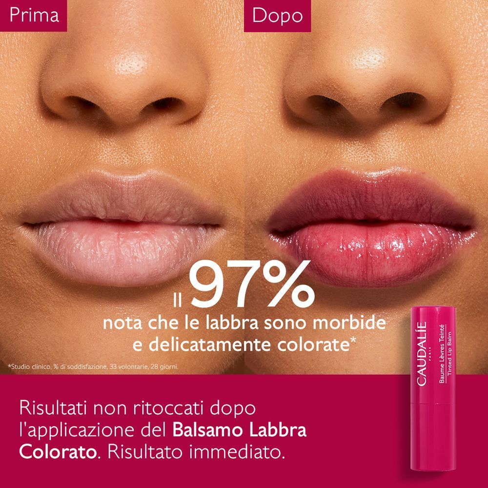 Confronto prima/dopo delle labbra trattate con balsamo labbra Caudalie.