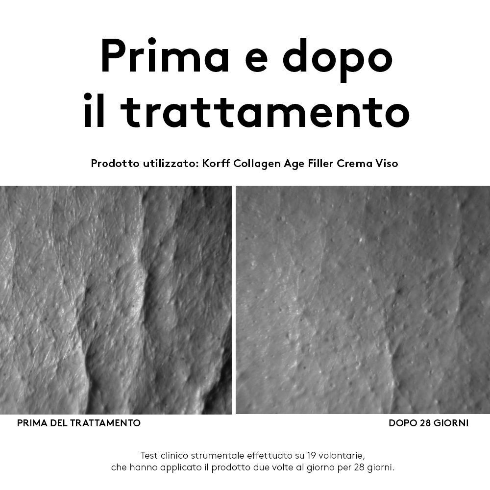 Immagine comparativa: pelle prima e dopo 28 giorni di trattamento KORFF Collagen Age Filler.